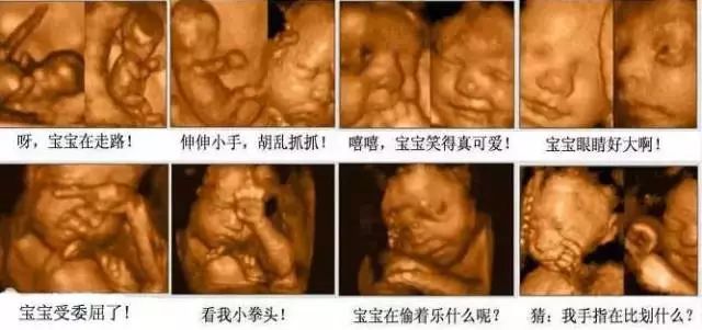 四维彩超价格揭秘，技术与经济的融合时代解读