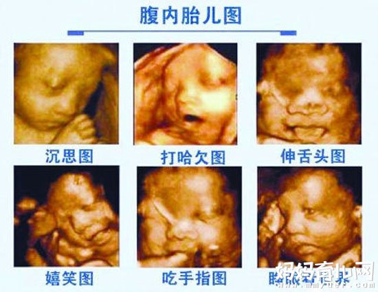 四维彩超价格揭秘,技术与经济的融合时代解读