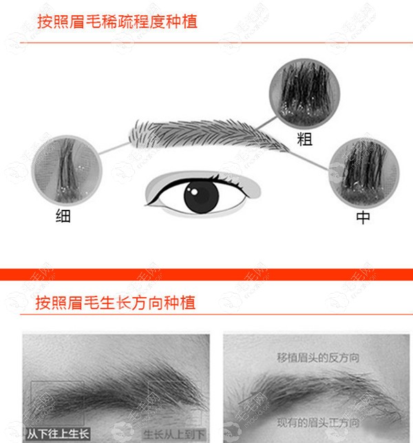 植眉价格全面解析，打造完美眉形，不留遗憾的美丽投资！