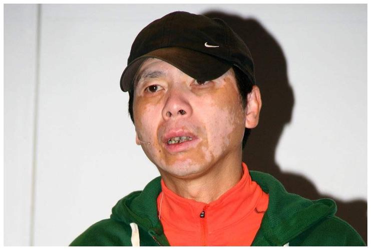 明星光环背后的健康真相，疾病与挑战
