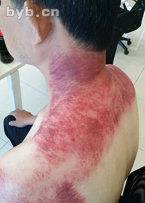 最新掀痧步骤详解,初学者与进阶用户指南