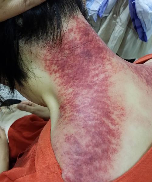 最新掀痧步骤详解,初学者与进阶用户指南